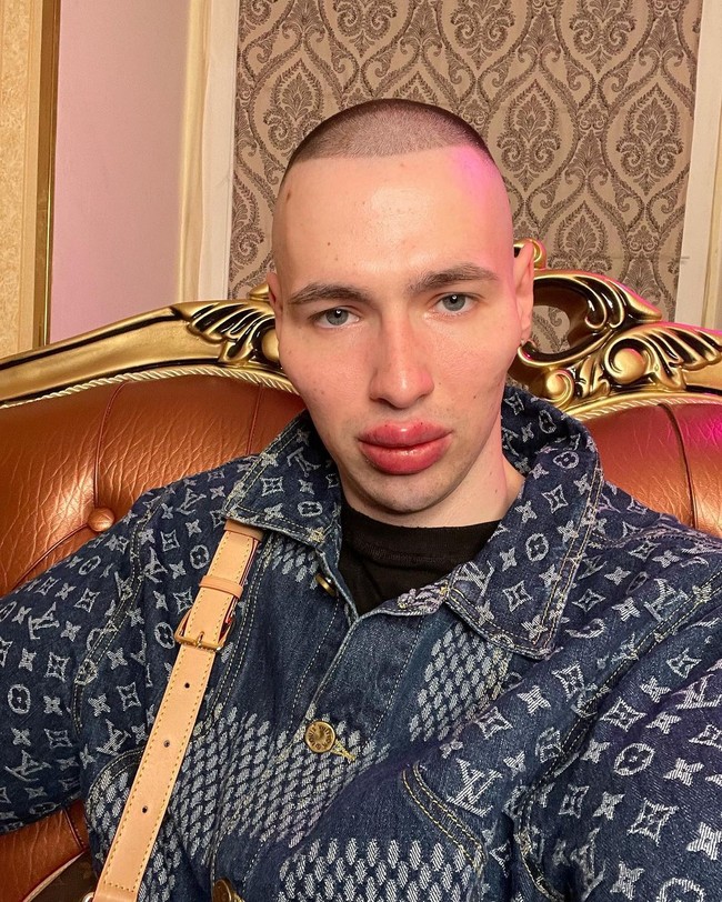 Dalam foto-foto terbarunya, pria 25 tahun tersebut bikin pangling dengan penampilannya. Bisa dilihat jika bagian bibir dan pipinya lebih terisi. Kirill juga tampak memperbaiki rahang dan dahinya sehingga lebih mirip alien daripada manusia.Foto: Instagram @ruki_bazuki_official