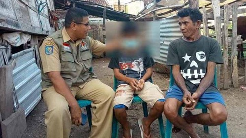Korban kekerasan anak di Bima, NTB, yang wajahnya diolesi cabai ulek oleh IRT.