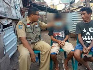 Kronologi Bocah di Bima Dijambak-Mata Diolesi Cabai Ibu Temannya