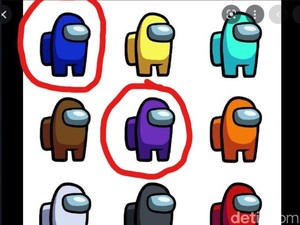 Apakah Buta Warna Parsial Bisa Disembuhkan? Ini Faktanya Menurut Dokter Mata