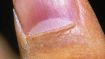 Spesies reptile yang ditemukan di Madagaskar. Foto: Boredpanda