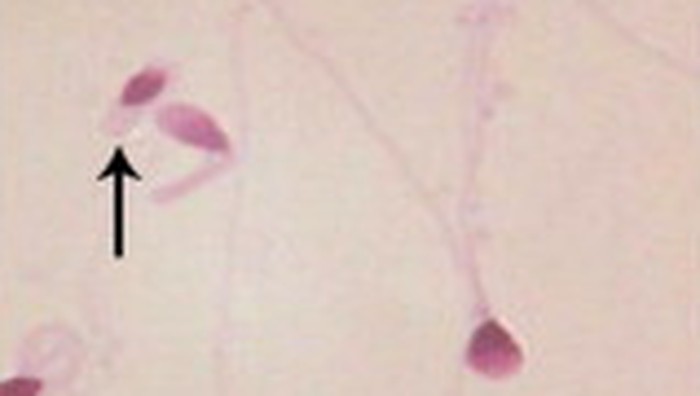 Bagian ekor terlalu pendek. (Foto: Middle East Fertility Society Journal/Sohair A. Abd El-baset)