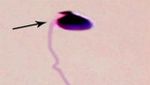 Penampakan Sperma di Bawah Mikroskop, Ini Beda yang Sehat Vs Abnormal