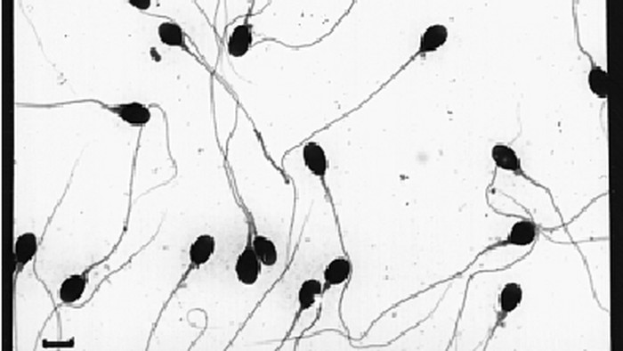 penampakan sperma di mikroskop Sperma manusia yang normal seperti ini. Memiliki kepala lonjong bulat seperti telur dengan ekor yang panjang dan kuat. (Foto: Journal Molecular Human Reproduction/Leslie Goodwin)