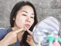 Asian woman having skin problem with acne face ,squeezing pimples with mirror