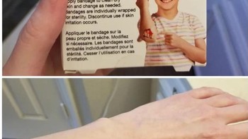 Ada-ada saja perban luka dengan gambar potongan kue keju strawberry. Foto: Brightside