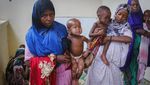 Foto Ini Tunjukkan Penderitaan Anak-anak Somalia yang Kena Gizi Buruk