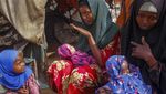 Foto Ini Tunjukkan Penderitaan Anak-anak Somalia yang Kena Gizi Buruk