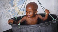 Sekarang dia membawa Ali Osman yang berusia tiga tahun yang lemah. Ali ia gendong dalam perjalanannya sejauh 90 kilometer dari desanya ke ibu kota Somalia.