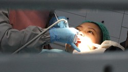 Sebanyak 300 relawan gigi di 72 kota di Indonesia lakukan perawatan lanjutan (scaling) kepada masyarakat. Mereka memberikan penjelasan tentang kesehatan gigi.