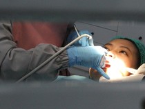 Cara Scaling Gigi Pakai BPJS Kesehatan