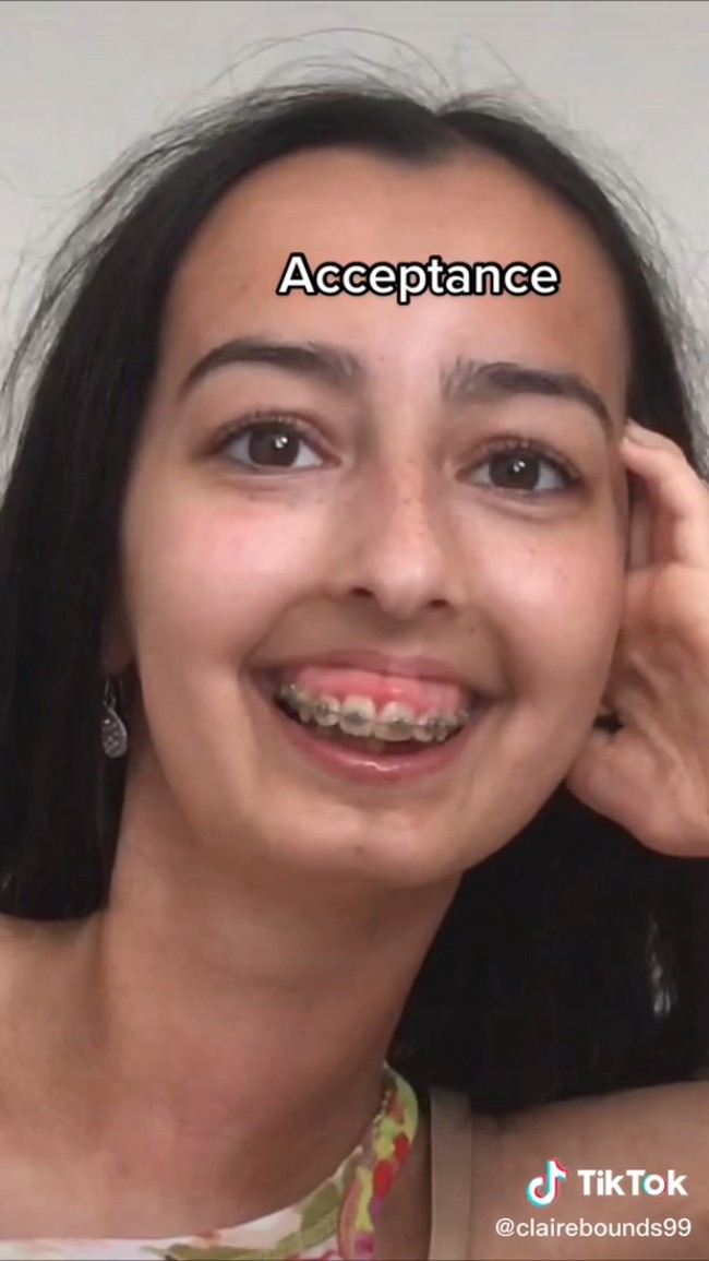 Sampai akhirnya Claire memilih untuk menerima keadaan. Foto: TikTok Claire Elizabeth