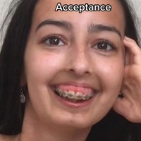 Sampai akhirnya Claire memilih untuk menerima keadaan. Foto: TikTok Claire Elizabeth