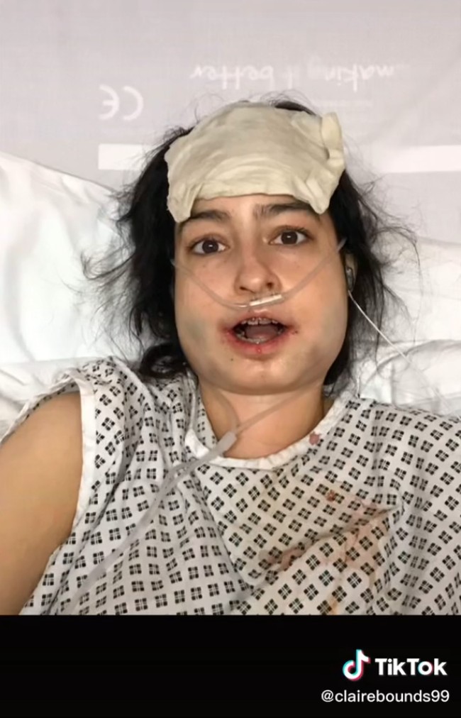 Tapi kemudian ia berubah pikiran dan memutuskan untuk melakukan operasi rekonstruksi wajah untuk memperbaiki bagian bawah wajahnya. Foto: TikTok Claire Elizabeth