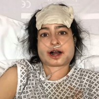 Tapi kemudian ia berubah pikiran dan memutuskan untuk melakukan operasi rekonstruksi wajah untuk memperbaiki bagian bawah wajahnya. Foto: TikTok Claire Elizabeth