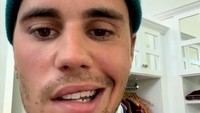 Seperti yang kalian lihat, mataku ini tidak bisa berkedip. Aku tidak bisa menunjukkan senyuman di sebelah wajahku. Lubah hidung ini tidak akan bergerak, ujar Justin Bieber. Foto: dok ist