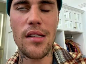 Ramsay Hunt Syndrome Justin Bieber Kambuh, Terpaksa Tunda Tur Lagi