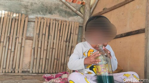 Balita di Sampang kecanduan hirup aroma bensin