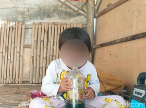 Balita Sampang Kecanduan Cium Aroma Bensin, Menangis Jika Dilarang