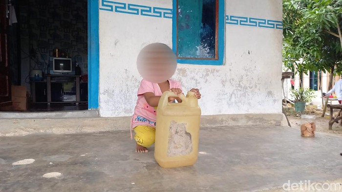 Balita di Sampang kecanduan bau bensin