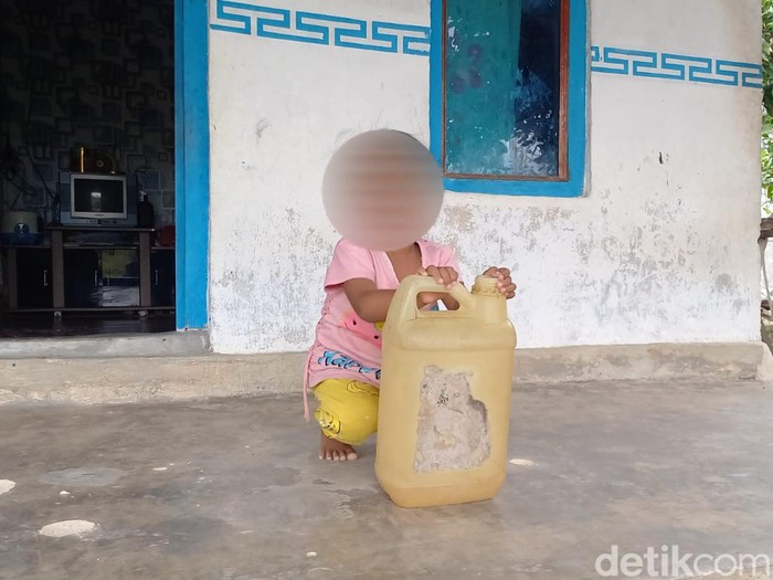 Balita di Sampang kecanduan bau bensin