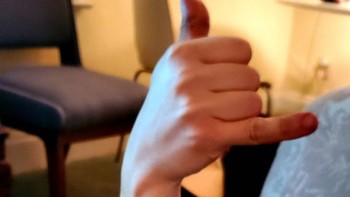 Stroberi berbentuk tangan manusia. Foto: Reddit via Brightside