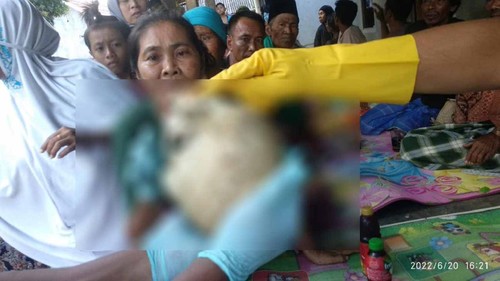 Kerangka manusia yang ditemukan di Lombok Tengah, NTB, Minggu (19/6/2022).