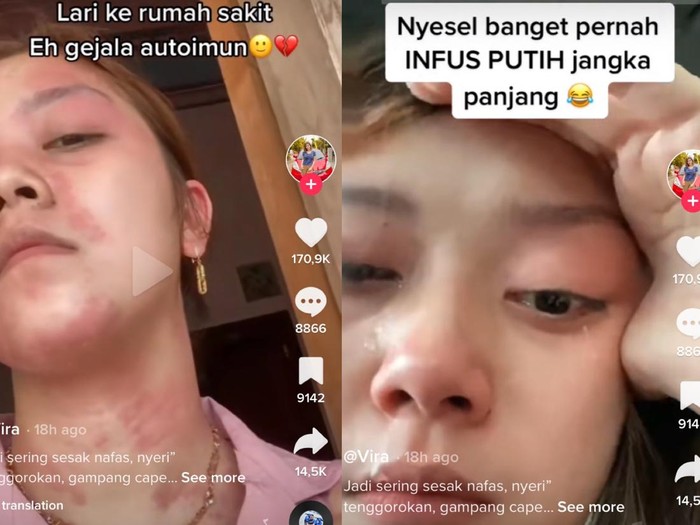 Viral wanita mengaku terkena autoimun usai sering disuntik putih seminggu hingga sebulan sekali.