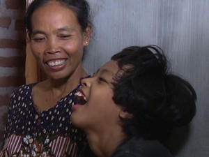 Mari Bantu Syifa, Anak Penjual Gerabah Idap Gangguan Saraf Otak