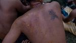 Kuat dan Berani, Begini Aksi Pria di Bali dalam Perang Pandan Berduri