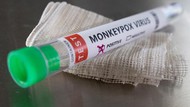 Tips Cegah Penularan Wabah Cacar Monyet dari Pakar UGM