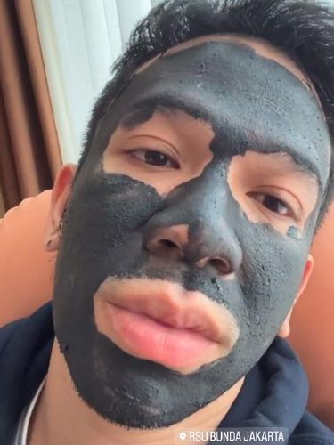 Jordi Onsu maskeran di rumah sakit saat temani Ruben Onsu.