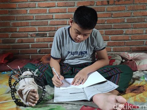 Fauzan bocah penderita kelainan bentuk tulang kaki di Sidoarjo bercita-cita menjadi dokter ortopedi
