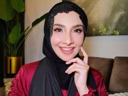 Foto Artis Selamatkan Anak dari Penculikan, Wajah Cantiknya Kini Luka-luka