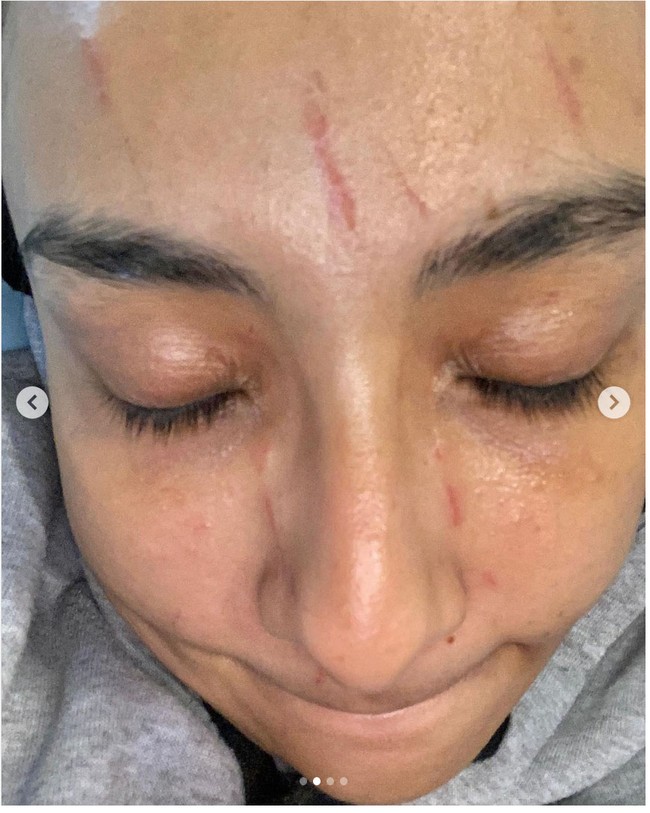 Dalam keterangan unggahannya yang ditulis dengan bahasa Melayu, Lufya mengungkapkan dua hari sebelum mengunggah foto, dia diserang oleh seorang pria yang mencoba menculik anak perempuannya. Foto: Dok. Instagram @lufyalaana