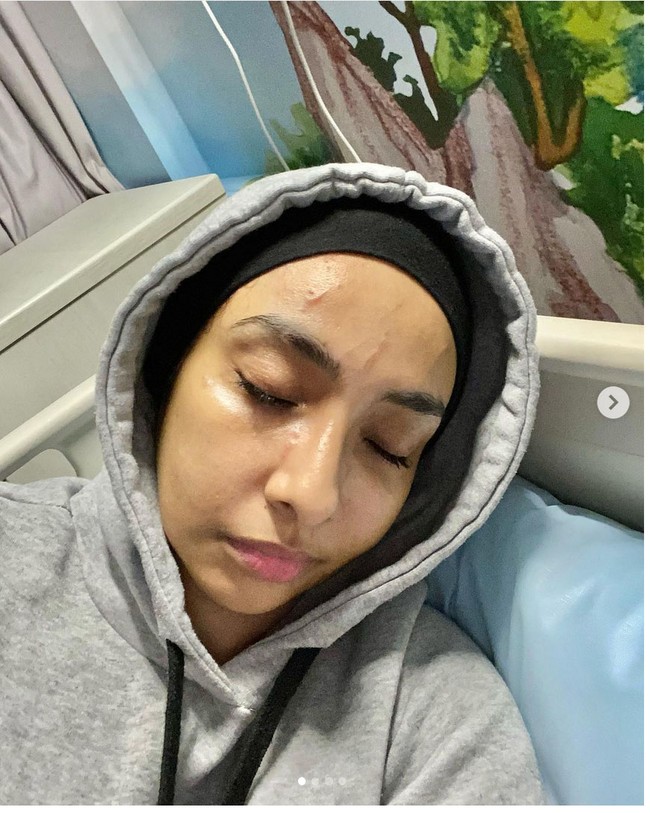 Pada Selasa (28/6/2022), Lufya Omar membuat unggahan yang menghebohkan netizen. Dia memamerkan wajahnya yang luka-luka. Foto: Dok. Instagram @lufyalaana