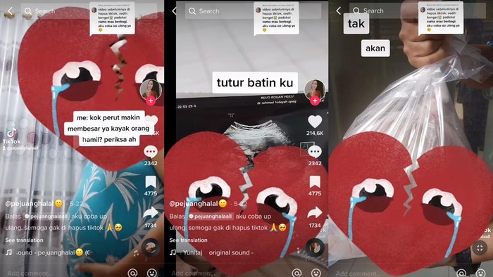 Viral TikTok kista Seorang wanita asal Riau memiliki perut besar, mulanya dikira karena jarang BAB. Ternyata kista 30 cm bersarang di luar rahim,