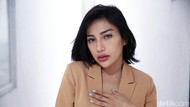 Rezy Adisty Pengusaha Seksi Pilih Operasi Kecilkan Dada