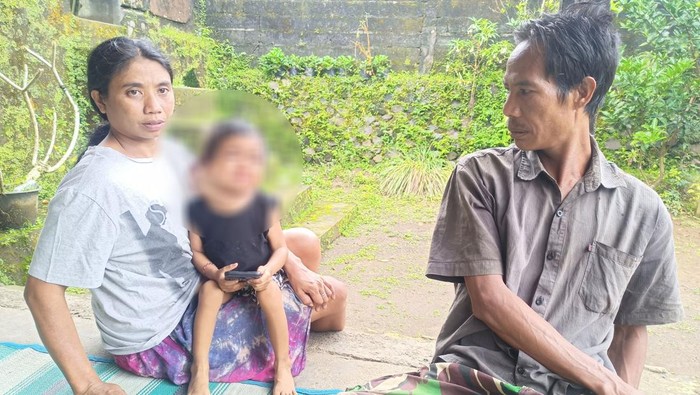 Ni Ketut EY, bocah yang menderita tumor ganas, dipangku oleh ibunya di rumahnya, di Desa Sangkan Gunung, Kecamatan Sidemen, Kabupaten Karangasem, Sabtu (2/7/2022)