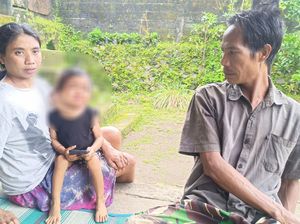 Dokter RSUP Sanglah Ungkap Kondisi Bocah Derita Kanker di Karangasem