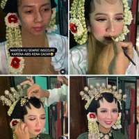 Acara pernikahan pengantin wanita itu digelar pada 26 Juli 2022 di Batanghari, Lampung Timur, Bandar Lampung. Elin mengungkapkan saat melihat kondisi wajah kliennya dan menjelaskan penanganannya. Reaksi awal lumayan tegang, pengantin aku ajak ngobrol dulu biar relax dan nggak insecure. Seperti yang sudah-sudah hampir sama sebenarnya dengan noda jerawat cara mengatasi nya. Hanya menggunakan foundie yang lumayan bisa cover noda-noda. Dan aku up warna tone foundie nya karena di kampung memang suka yang putih-putih bikin mangling, ucap MUA yang berusia 37 tahun itu. Foto: Dok. Instagram @elinnherlin_.