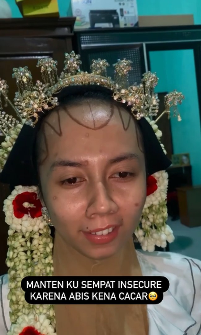 Wanita ini merasa kurang percaya diri alias insecure karena memiliki bekas cacar di wajahnya. Kepercayaan dirinya langsung luntur setelah melihat transformasi makeupnya sebagai pengantin yang bikin terkejut. Kisah pengantin wanita dengan bekas cacar di wajah itu viral setelah dibagikan oleh akun TikTok @elin.afiat. Dalam unggahannya, dia memperlihatkan perubahan wajah sebelum dan sesudah makeup. Pengantin ku sempat insecure karena noda cacar, tulis akun TikTok @elin.afiat. Foto: Dok. Instagram @elinnherlin_.