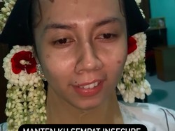7 Foto Transformasi Makeup Pengantin Viral dengan Bekas Cacar
