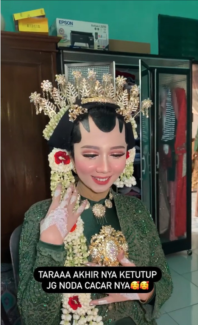 Elin menjadi MUA sejak tahun 2018. Ia menuturkan proses makeup pengantin dengan bekas cacar itu dilakukannya selama dua jam. Video unggahannya viral, ia memberikan tanggapannya. Aku senang karena banyak juga yang suka sama perubahan manten ternyata. Alhamdulillah bisa edukasi netizen juga kalau makeup dempul itu salah satu tujuannya adalah meng-cover bekas luka, tuturnya. Foto: Dok. Instagram @elinnherlin_.