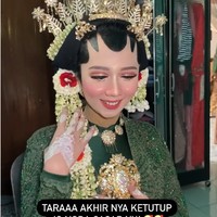 Elin menjadi MUA sejak tahun 2018. Ia menuturkan proses makeup pengantin dengan bekas cacar itu dilakukannya selama dua jam. Video unggahannya viral, ia memberikan tanggapannya. Aku senang karena banyak juga yang suka sama perubahan manten ternyata. Alhamdulillah bisa edukasi netizen juga kalau makeup dempul itu salah satu tujuannya adalah meng-cover bekas luka, tuturnya. Foto: Dok. Instagram @elinnherlin_.