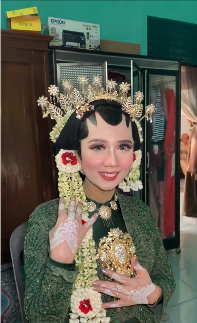 MUA Elin menyebutkan bagi calon pengantin wanita yang menghadapi masalah yang sama, agar tetap tenang dan tidak gugup saat hari pernikahan. Setiap pengantin punya kecemasan yang berbeda-beda, maklum karena hari besar. Jadi aku memberi saran untuk tetap relax dan fokus ke hal-hal yang menyenangkan. Supaya para pengantin terhindar dari stres saat hari H dan percaya kan semuanya kepada vendor masing-masing yang bertugas, pungkas Elin. Foto: Dok. Instagram @elinnherlin_.