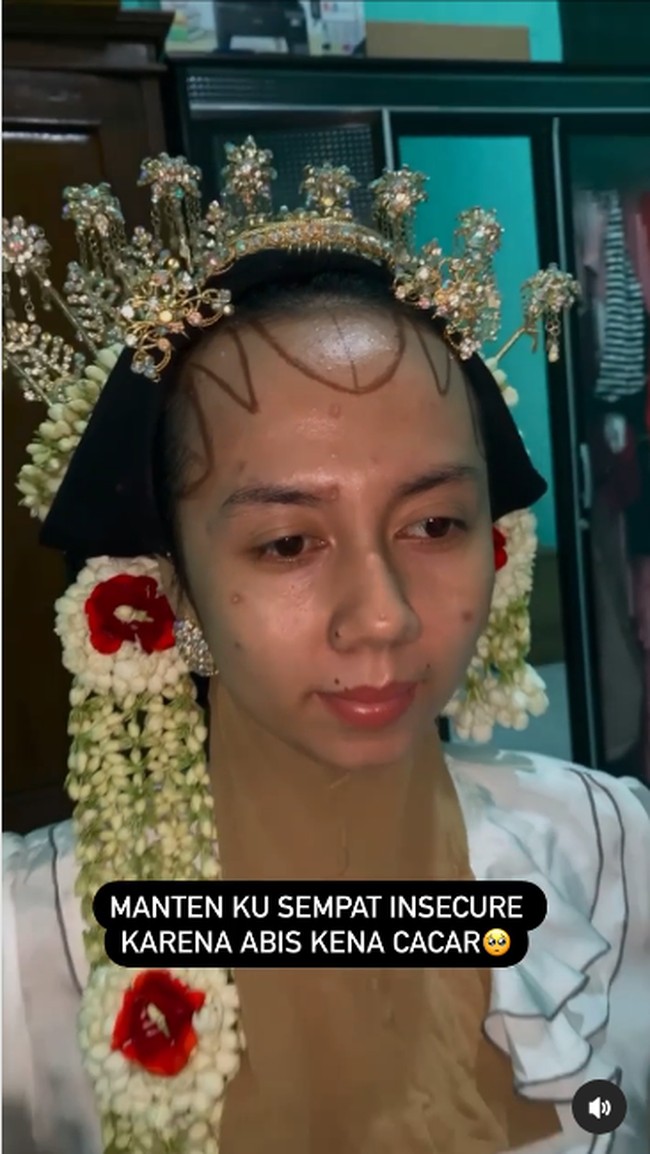 Saat proses makeup pengantin wanita terlihat tenang. Sang MUA terlihat mengaplikasikan foundation, hightlighter, ombre lips, hingga paes hijab khas Jawa pada sang pengantin. Taraaa noda cacar ter-cover jadi cantik, ucap lega akun @elin.afiat. Foto: Dok. TikTok @elin.afiat.
