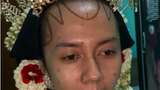Viral Transformasi Makeup Pengantin dengan Bekas Cacar, Bikin Terkejut
