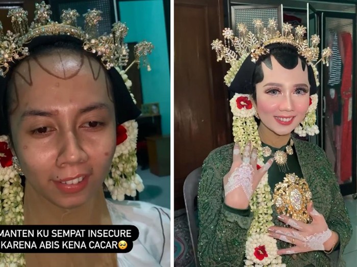 Pengantin viral insecure dengan bekas cacar, hasil makeupnya bikin pangling. Pengantin viral insecure dengan bekas cacar, hasil makeupnya bikin pangling.
