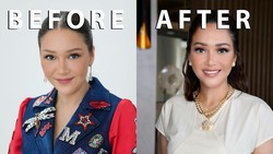 10 Potret Maia Estianty Sebelum vs Sesudah Laser-Botox